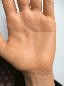 Как выглядит двойная линия сердца?